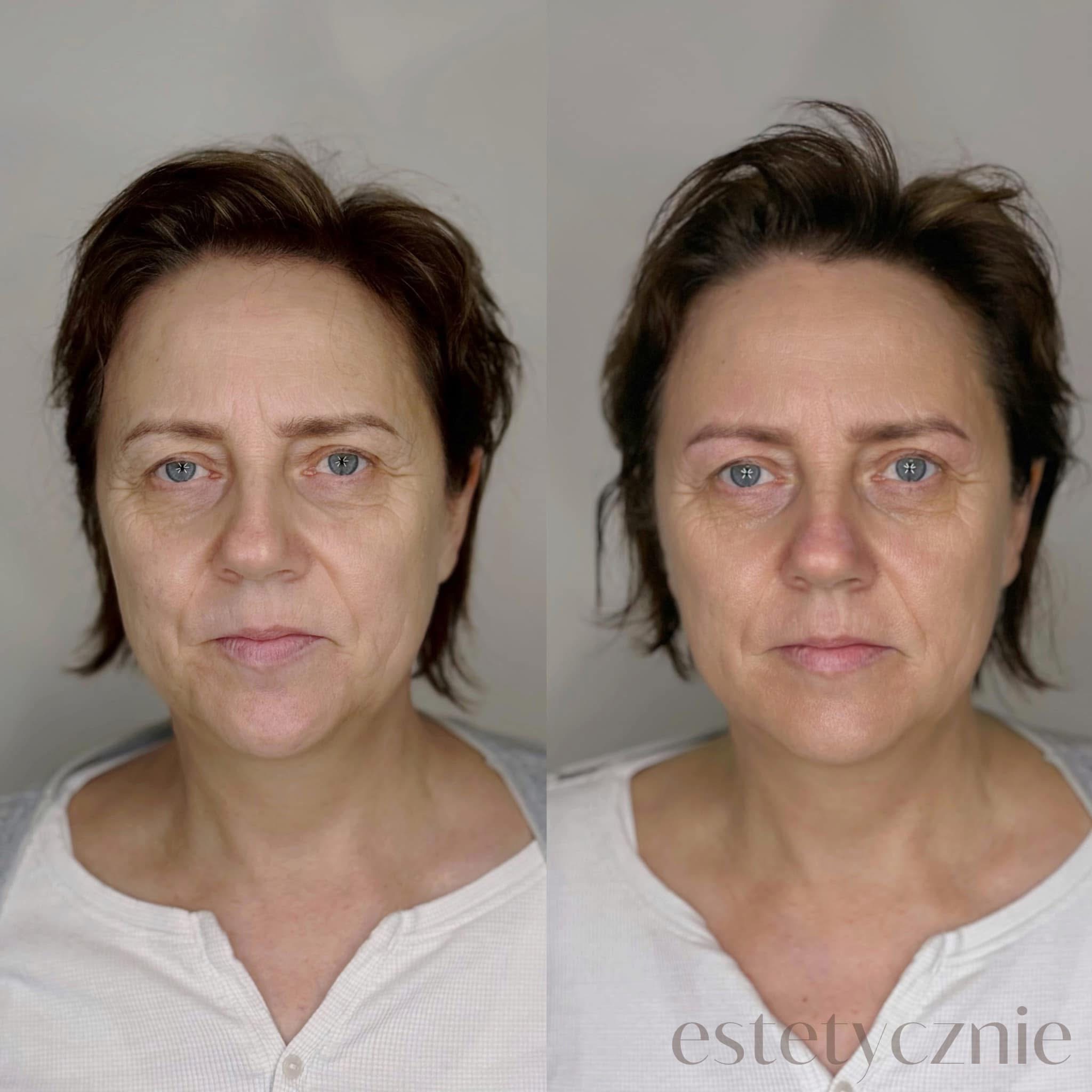 Pielęgnacja - Efekt 4